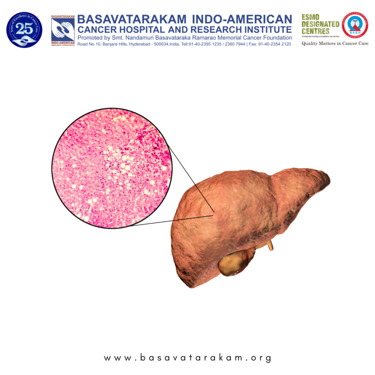 Basavatarakam Indo-American Cancer Hospital and Research Institute (10)