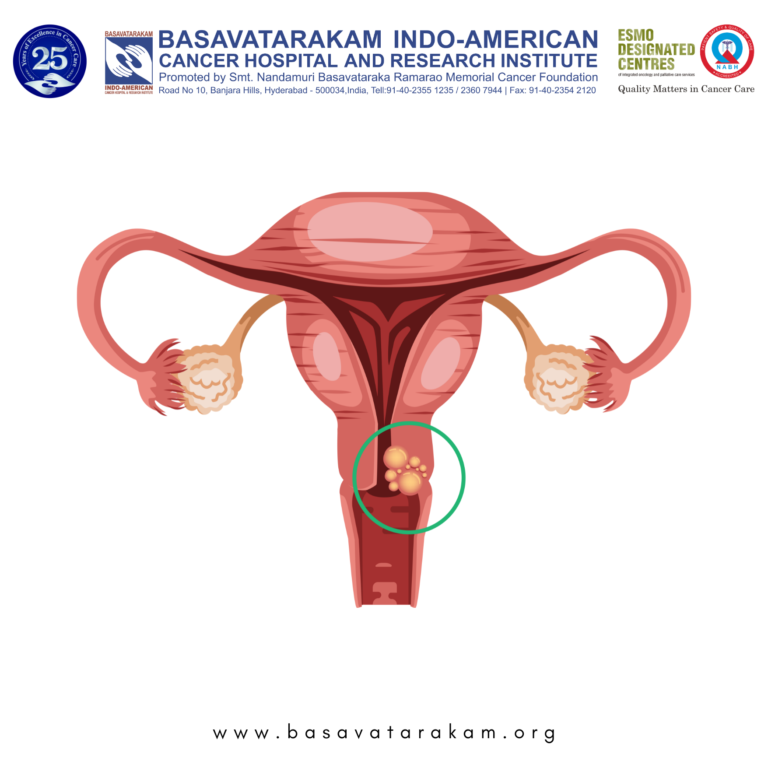 Basavatarakam Indo-American Cancer Hospital and Research Institute (12)