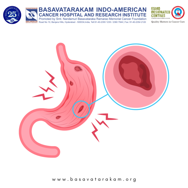 Basavatarakam Indo-American Cancer Hospital and Research Institute (14)