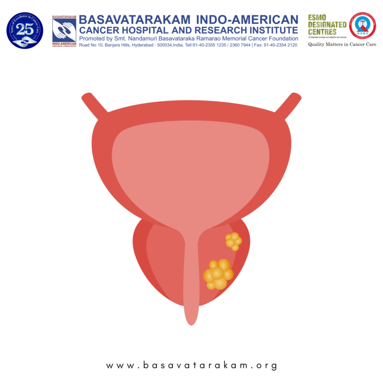 Basavatarakam Indo-American Cancer Hospital and Research Institute (17)