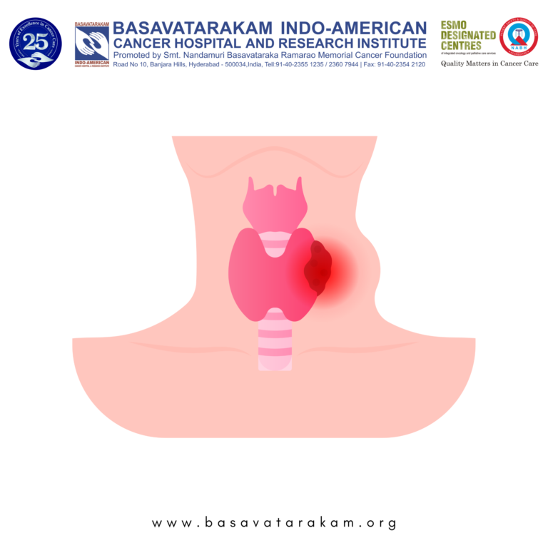 Basavatarakam Indo-American Cancer Hospital and Research Institute (18)